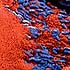 Wound Infection